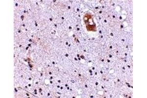 Immunohistochemistry (IHC) image for anti-Transmembrane Channel-Like 8 (TMC8) (Middle Region) antibody (ABIN1030928) (TMC8 antibody  (Middle Region))