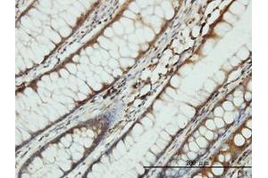 Image no. 2 for anti-Serine--tRNA Ligase, Cytoplasmic-Like (AA 1-515) antibody (ABIN598916) (Serine--tRNA Ligase, Cytoplasmic-Like (AA 1-515) antibody)