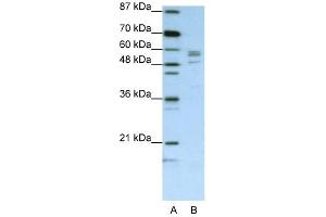 SARS antibody used at 1. (Seryl-tRNA Synthetase (SARS) (C-Term) antibody)