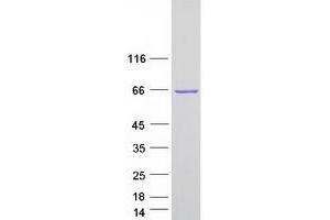 Western Blotting (WB) image for Plastin 1 (PLS1) (Transcript Variant 1) protein (Myc-DYKDDDDK Tag) (ABIN2729117)