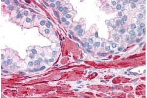 Immunohistochemistry (Formalin-fixed Paraffin-embedded Sections) (IHC (fp)) image for anti-Filamin A, alpha (FLNA) (AA 1819-2068) antibody (ABIN604950)