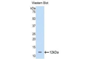 Western Blotting (WB) image for anti-Nucleophosmin (Nucleolar phosphoprotein B23, Numatrin) (NPM1) (AA 204-290) antibody (ABIN1860041)
