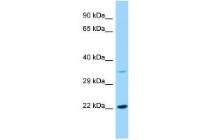Host: Rabbit Target Name: KDELR2 Sample Type: RPMI-8226 Whole Cell lysates Antibody Dilution: 1. (KDELR2 antibody  (Middle Region))