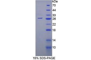 SDS-PAGE analysis of Mouse Monoamine Oxidase A Protein. (Monoamine Oxidase A Protein (MAOA))