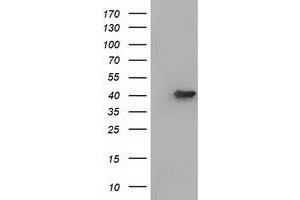 HEK293T cells were transfected with the pCMV6-ENTRY control (Left lane) or pCMV6-ENTRY ACAT2 (Right lane) cDNA for 48 hrs and lysed. (ACAT2 antibody)