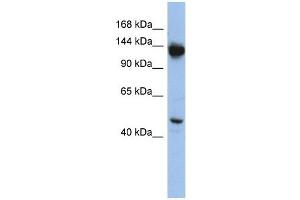NRD1 antibody used at 1 ug/ml to detect target protein.