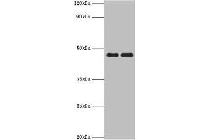 Western blot All lanes: Paired box protein Pax-6 antibody at 1 μg/mL Lane 1: Mouse stomach tissue Lane 2: Mouse eye tissue Secondary Goat polyclonal to rabbit IgG at 1/10000 dilution Predicted band size: 47, 49 kDa Observed band size: 47 kDa