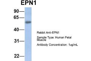 Host: Rabbit Target Name: EPN1 Sample Type: Human Fetal Muscle Antibody Dilution: 1. (Epsin 1 antibody  (C-Term))