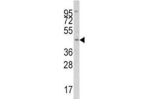 Western blot analysis of IRF8 antibody and Jurkat lysate. (IRF8 antibody  (AA 241-269))