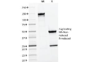 SDS-PAGE Analysis Purified CD22 Mouse Monoclonal Antibody (BLCAM/1796). (CD22 antibody  (AA 52-178))