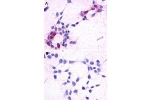 Immunocytochemistry (ICC) staining of HEK293 human embryonic kidney cells transfected (A) or untransfected (B) with GPR44. (Prostaglandin D2 Receptor 2 (PTGDR2) (3rd Extracellular Domain) antibody)