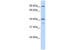 OAS1 antibody used at 0. (OAS1 antibody  (Middle Region))