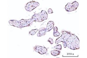 IHC analysis of RNGTT using anti-RNGTT antibody (ABIN7599723). (RNGTT antibody  (AA 11-438))