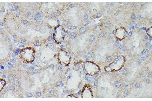 Immunohistochemistry of paraffin-embedded Rat kidney using NDUFAB1 Polyclonal Antibody at dilution of 1:100 (40x lens). (NDUFAB1 antibody)
