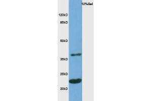 Mouse brain probed with Rabbit Anti-MOG Polyclonal Antibody, Unconjugated  at 1:3000 for 90 min at 37˚C.