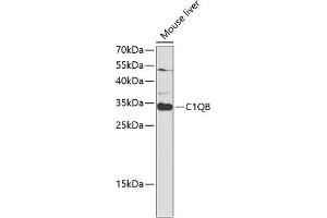 Western blot analysis of extracts of mouse liver, using C1QB antibody (ABIN6131395, ABIN6137754, ABIN6137756 and ABIN6220972) at 1:1000 dilution. (C1QB antibody  (AA 104-253))