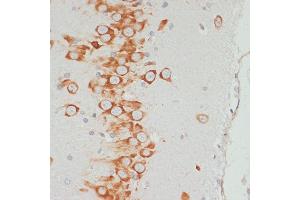 Immunohistochemistry of paraffin-embedded rat brain using Phospho-VASP-S157 antibody (ABIN6135335, ABIN6136286, ABIN6136287 and ABIN6225657) at dilution of 1:100 (40x lens). (VASP antibody  (pSer157))