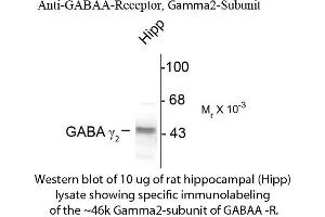 Western blot of GABAA Receptor γ2 Antibody Western Blot of Rabbit anti-GABAA Receptor γ2 Antibody. (GABRG2 antibody  (Cytoplasmic Loop))