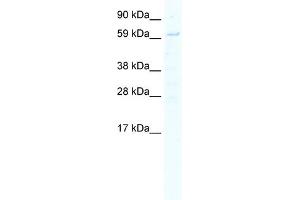 WB Suggested Anti-STAT1 Antibody Titration:  5. (STAT1 antibody  (N-Term))