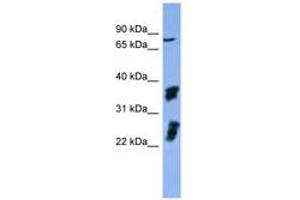 Image no. 1 for anti-Fibroblast Growth Factor Receptor 2 (FGFR2) (AA 508-557) antibody (ABIN6746746)