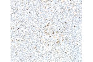Immunohistochemistry (IHC) image for anti-Runt-Related Transcription Factor 2 (RUNX2) (AA 300-350) antibody (ABIN7795797) (Recombinant RUNX2 antibody  (AA 300-350))