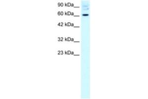 Western Blotting (WB) image for anti-Forkhead Box J2 (FOXJ2) antibody (ABIN2460611) (Forkhead Box J2 antibody)