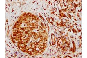 Immunohistochemistry (IHC) image for anti-Heterogeneous Nuclear Ribonucleoprotein K (HNRNPK) antibody (ABIN7127548)