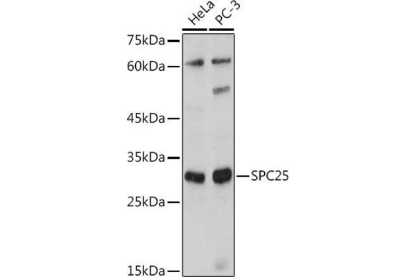 SPC25 抗体  (AA 1-224)