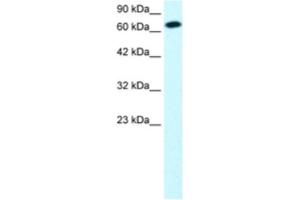 Western Blotting (WB) image for anti-Signal Transducer and Activator of Transcription 4 (STAT4) antibody (ABIN2460707) (STAT4 antibody)