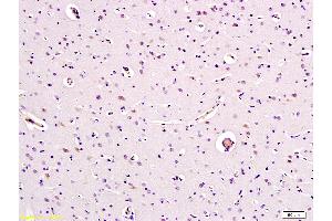 Paraformaldehyde-fixed, paraffin embedded Human Brain Antigen retrieval by boiling in sodium citrate buffer (pH6. (Caspase 9 antibody  (AA 271-314))