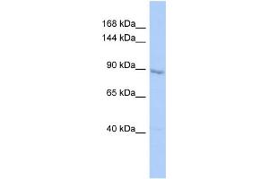 Host:  Rabbit  Target Name:  UHRF1  Sample Type:  HepG2 Whole cell lysates  Antibody Dilution:  1. (UHRF1 antibody  (C-Term))