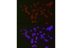 Immunofluorescence analysis of Neuro-2a cells using α-Synuclein Rabbit mAb (ABIN7270695) at dilution of 1:100 (40x lens). (SNCA antibody  (AA 59-140))