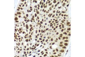 Immunohistochemistry (Paraffin-embedded Sections) (IHC (p)) image for anti-Splicing Factor 3b, Subunit 2, 145kDa (SF3B2) (AA 616-895) antibody (ABIN6147666)