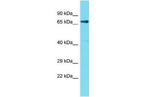 Host: Rabbit  Target Name: Fem1c  Sample Tissue: Rat Kidney lysates  Antibody Dilution: 1. (FEM1C antibody  (C-Term))