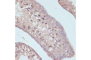 Immunohistochemistry of paraffin-embedded mouse testis using D antibody (ABIN7265495) at dilution of 1:100 (40x lens). (ARL4D antibody  (AA 92-201))