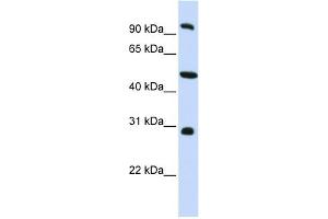 EML1 antibody used at 1 ug/ml to detect target protein. (EML1 antibody  (C-Term))