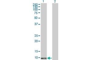 Western Blot analysis of ERAF expression in transfected 293T cell line by ERAF polyclonal antibody (A01). (aHSP antibody  (AA 1-102))