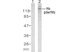 Western blot analysis of extracts from K562 cells untreated or treated with 10% serum after 48 hours of starvation, using Rb (phospho-Ser795) antibody (E011130). (Retinoblastoma 1 antibody  (pSer795))