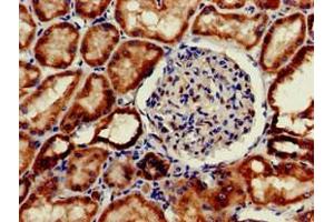 Immunohistochemistry of paraffin-embedded human kidney tissue using ABIN7156331 at dilution of 1:100 (Insulin Receptor antibody  (AA 1023-1298))