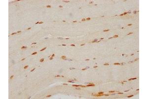 IHC image of ABIN7127502 diluted at 1:70 and staining in paraffin-embedded human skeletal muscle tissue performed on a Leica BondTM system. (Recombinant FTO antibody)