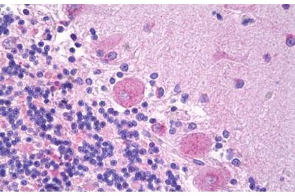 BNP32 antibody