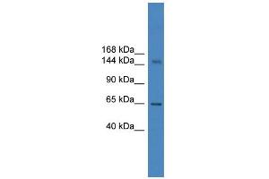 WB Suggested Anti-DHX57 Antibody Titration: 0. (DHX57 antibody  (C-Term))