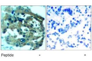 Image no. 1 for anti-Neurofibromin 2 (NF2) (AA 516-520) antibody (ABIN197520) (Merlin antibody  (AA 516-520))