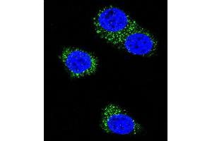 Confocal immunofluorescent analysis of Presenilin 1 (PSEN1) Antibody (C-term) (ABIN390169 and ABIN2840665) with MDA-M cell followed by Alexa Fluor 488-conjugated goat anti-rabbit lgG (green). (Presenilin 1 antibody  (C-Term))