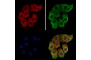 ABIN7094600 and ABIN7098650 staining Hela cells by IF/ICC.