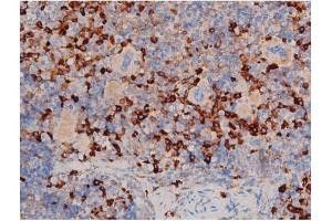 Immunohistochemistry (IHC) image for anti-Cell Division Cycle 25 Homolog A (S. Pombe) (CDC25A) (pSer178) antibody (ABIN6256174)