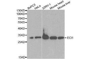 Western blot analysis of extracts of various cell lines, using ECI1 antibody. (DCI antibody  (AA 63-302))