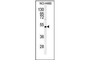 Western blot analysis of DGAT2 Antibody (N-term) in NCI-H460 cell line lysates (35ug/lane).