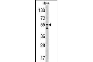 Western blot analysis of CA9 antibody (Center) (ABIN390041 and ABIN2840124) in Hela cell line lysates (35 μg/lane). (CA9 antibody  (AA 113-143))