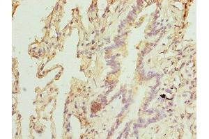 Immunohistochemistry of paraffin-embedded human lung tissue using ABIN7151467 at dilution of 1:100 (TPRKB antibody  (AA 1-175))